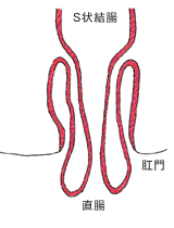 直腸脱について/皮膚科/肛門科/外科/消化器科/内科【林医院】(秋葉原・上野・御徒町・湯島・神田)